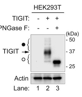 Western blotting analysis of full-length TIGIT-transfected HEK293T.jpg